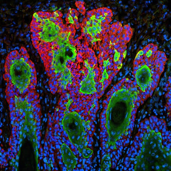 Replimune skin cancer drug that became FDA flashpoint is rejected again