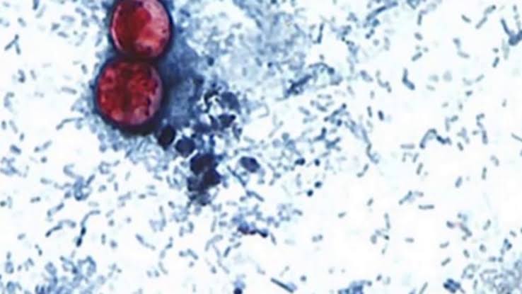 Cyclosporiasis outbreaks: What to know about the foodborne illness and symptoms