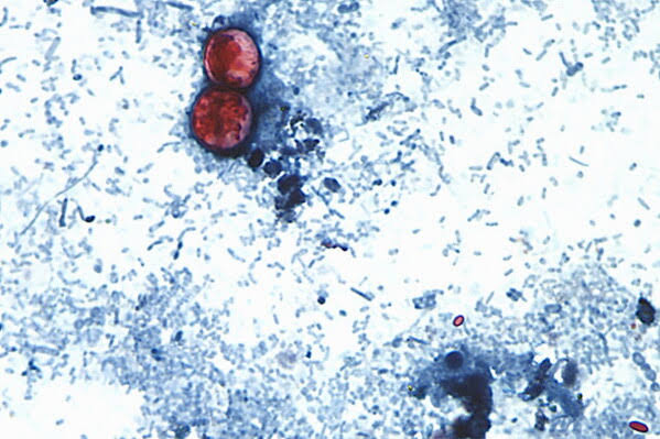 US health officials are investigating a new outbreak of a diarrhea-causing parasite