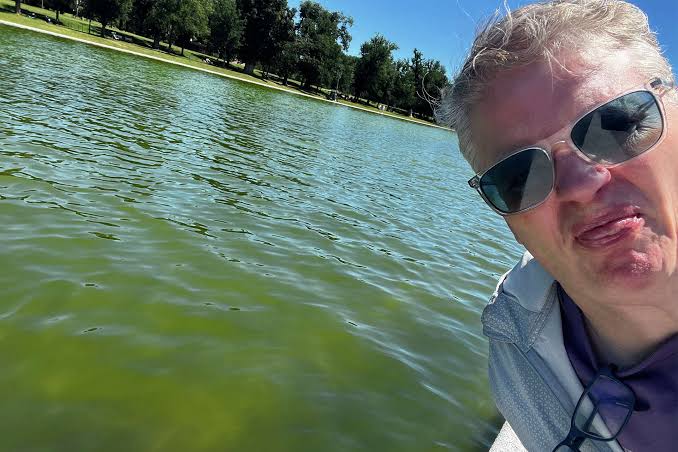 Congratulations, the Reflecting Pool is now a swamp