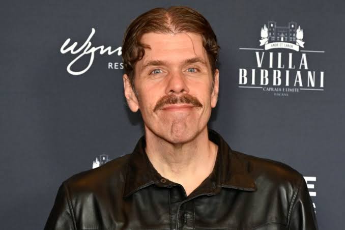 Perez Hilton 'Will Require Surgery' After Live Stream Incident