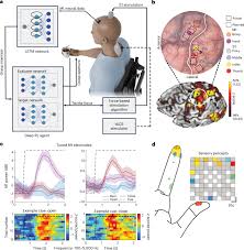 A neuroprosthesis for restoring hand movement and sensation in a person with complete tetraplegia