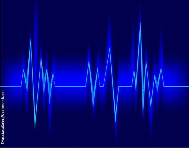 FDA-cleared AI tool flags hidden heart disease from a standard ECG
