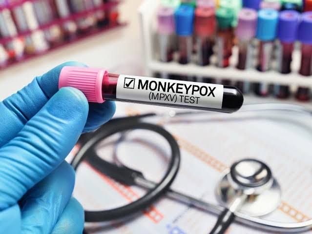 Connecticut Confirms First Case Of Clade I Mpox