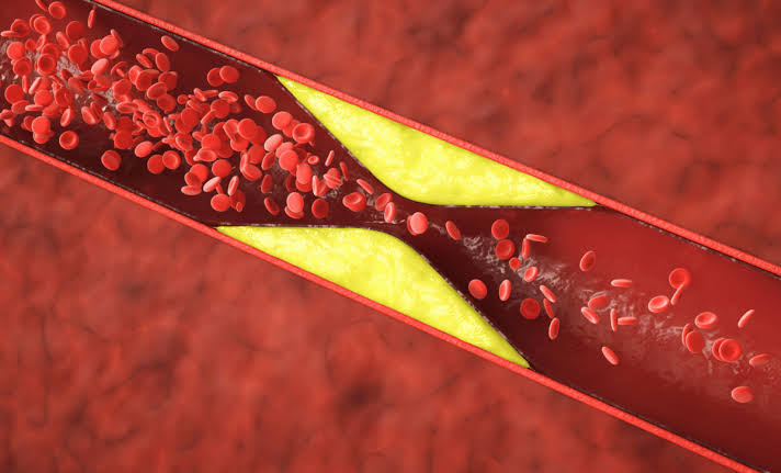 US Cardiologists Just Released New Guidelines That Could Transform Cholesterol Prevention Forever
