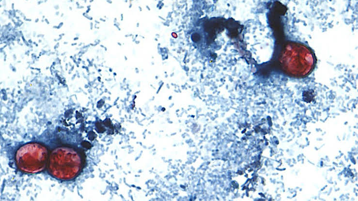 Cyclosporiasis confirmed in Hawaii visitor