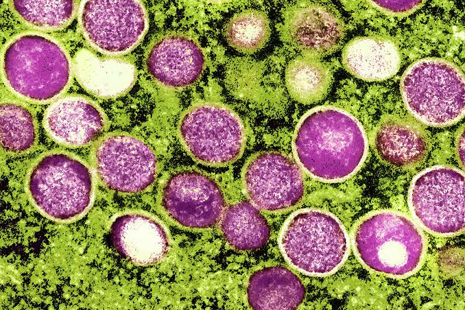 Calif. officials concerned as weekly average mpox cases 'more than double'