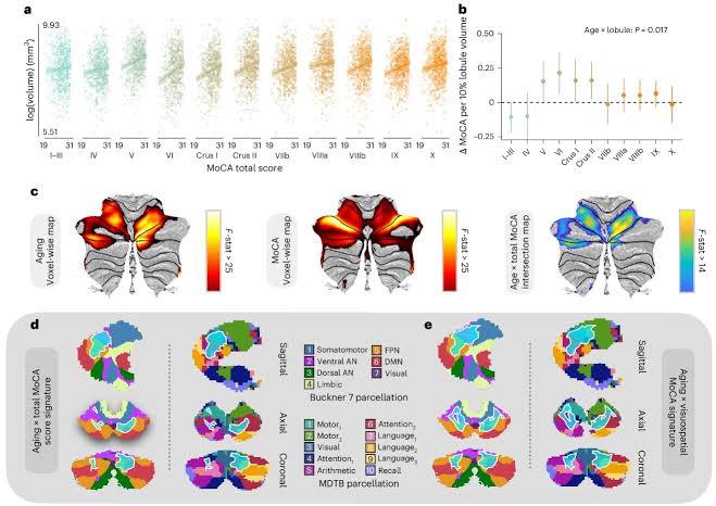 Uneven cerebellum aging may partly explain why some older adults stay mentally sharp