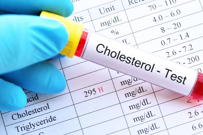 American College of Cardiology, American Heart Association Update Guidelines for the Management of Dyslipidemia