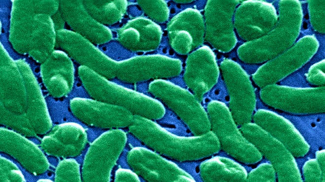 Palm Beach County person dies of 'flesh-eating bacteria'