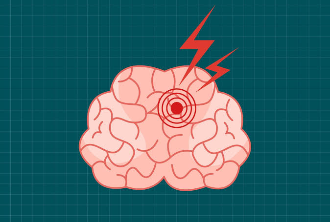 This 5-Minute Daily Habit Could Significantly Lower Your Stroke Risk, New Study Says
