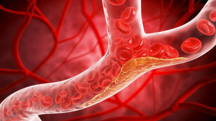 New cholesterol guidelines could change when you get tested