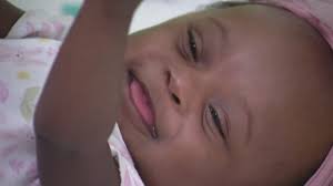 7-month-old undergoes life-saving bloodless open heart surgery at Seattle Children’s