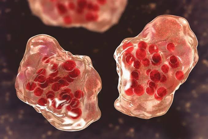 Measles exposure confirmed at NE Portland emergency room