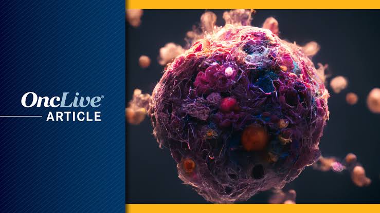 Rising Early-Onset Cancer Incidence Prompts Novel Management Strategies, Research