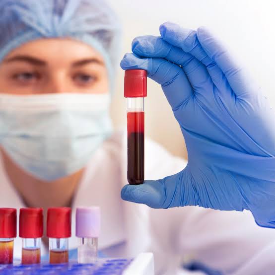 Simple Blood Test May Predict Alzheimer’s Years Before Brain Scans Show Signs