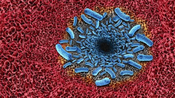Deadly infection: Florida reports first rare, flesh-eating bacteria death of the year
