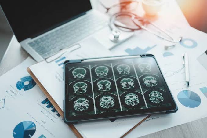 Specialists Are Practically Begging People To Eat These 3 Foods That Actually Lower Dementia Risk