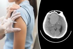 It’s not just Depo-Provera — study links 5 more birth control drugs to brain tumor risk