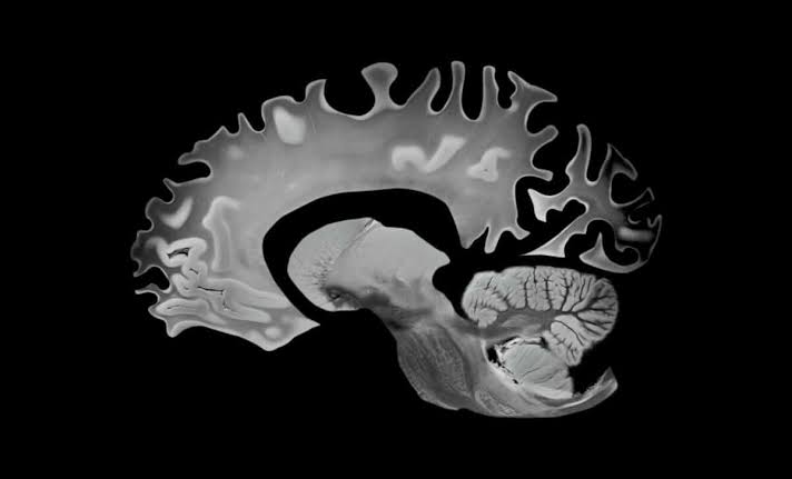 This “Hybrid” Diet Doesn’t Just Protect Your Heart, It’s Slowing Brain Aging Too