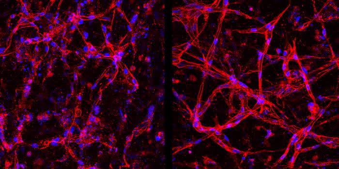 Lab-grown retinal cells show promise for new eye therapies