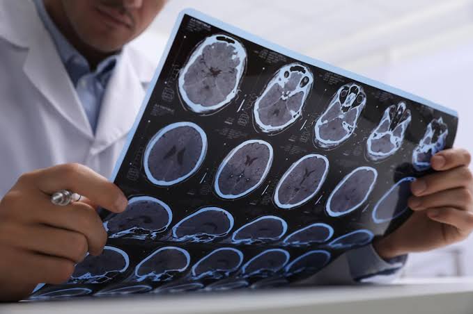 One Childhood Diet Habit Was Linked to a 46% Lower Alzheimer’s Risk