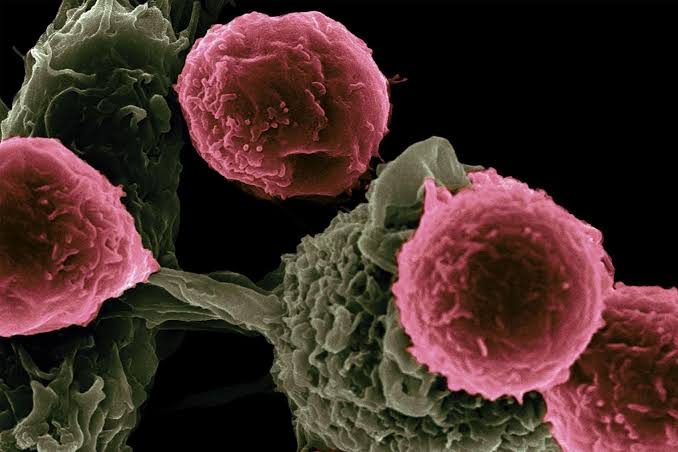 Revolutionary Therapy Cured Three "Incurable" Autoimmune Diseases in a Patient