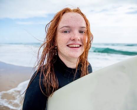 Red hair gene favoured by natural selection over last 10,000 years, study finds | Evolution