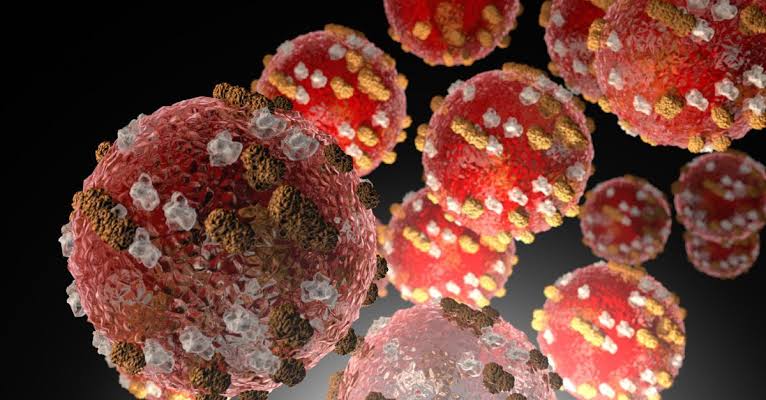 Measles case confirmed in Holmes County, Ohio
