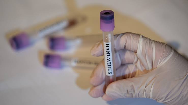 CDC says there are no U.S. hantavirus cases currently, 41 people being monitored