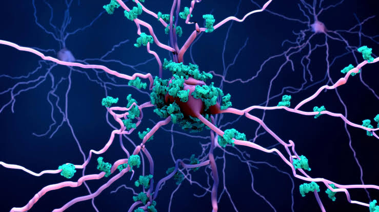 Scientists may have finally found how Alzheimer's kills brain cells