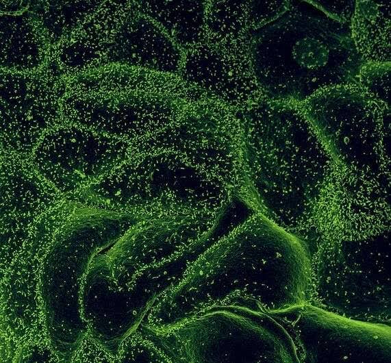 US activates highest-level response to Ebola outbreak
