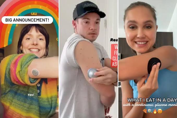 Influencers are hopping on a surprising wearable trend that requires a needle — do you need one?