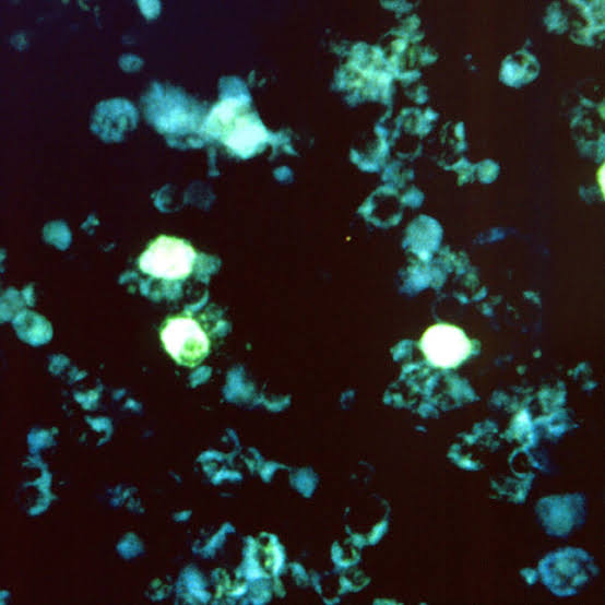 New study untangles how Epstein-Barr viral infection triggers immune response in multiple sclerosis