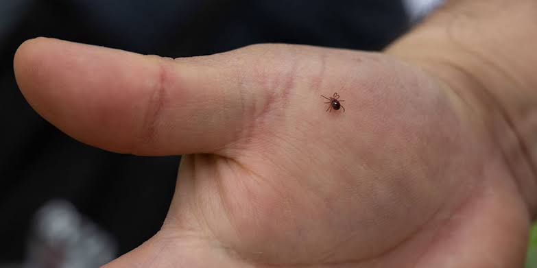 The U.S. is seeing one of the worst tick seasons on record. Here’s how Tennessee doctors recommend safely removing a tick