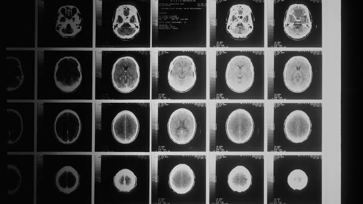 Psychedelics are revealing how the brain builds the sense of self