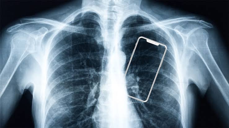 Your Smartphone Is Changing Your Body. Doctors Say Most People Don't Know It's Happening
