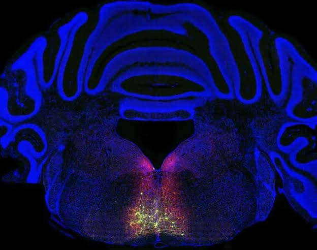 Brain Circuit That "Invents" Chronic Pain Identified