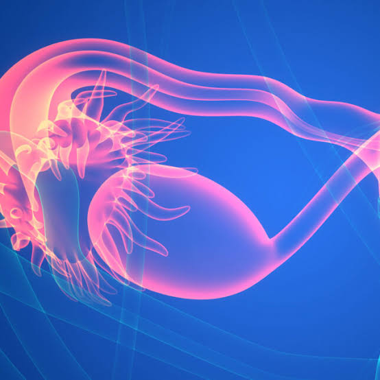 PCOS’s new name is PMOS, a small letter change that required a big scientific process