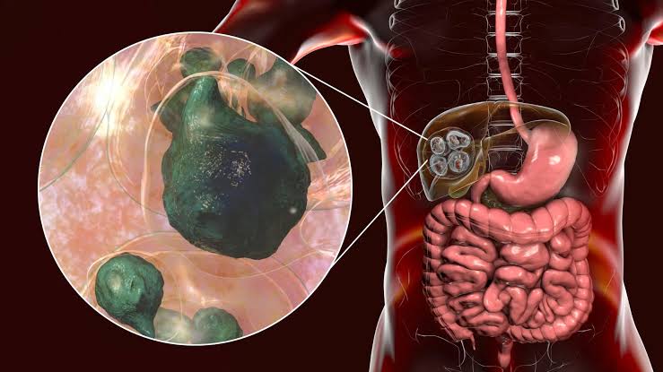 The deadly tapeworm spreading across America has reached the Pacific Northwest