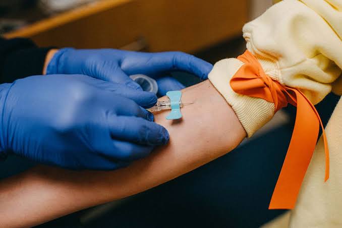 Blood Test Could Diagnose Alzheimer’s and Predict Symptoms 5 to 10 Years Before They Begin