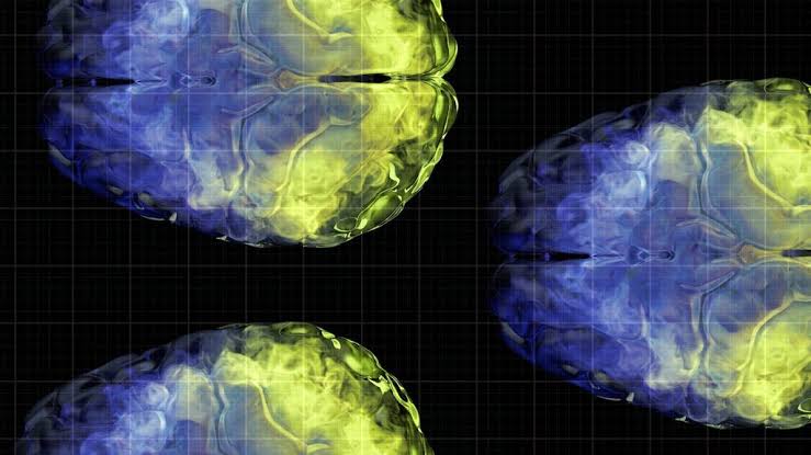 Aging brain health: Vitamin C levels linked to gray matter volume
