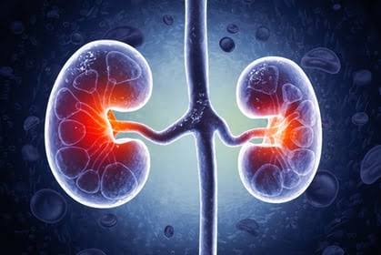 Kidney News in Brief: First CKM Guideline Issued, PKD Research Bill Introduced
