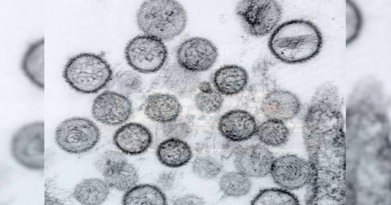 Hantavirus and COVID: Similar fears, major differences