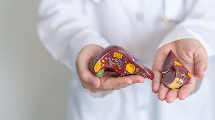 Most people ignore Fatty Liver until it's too late: Liver transplant surgeon explains why weight loss could change everything