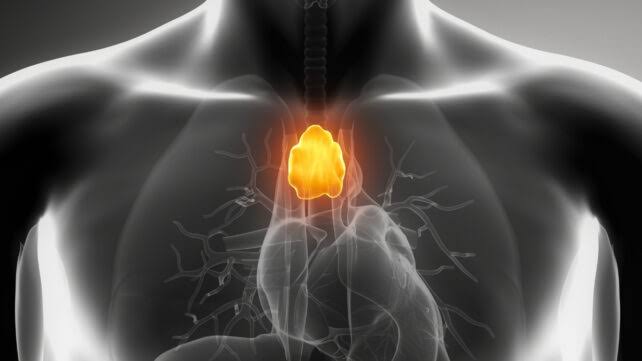 A 'Useless' Organ That Doctors Often Remove May Actually Fight Cancer