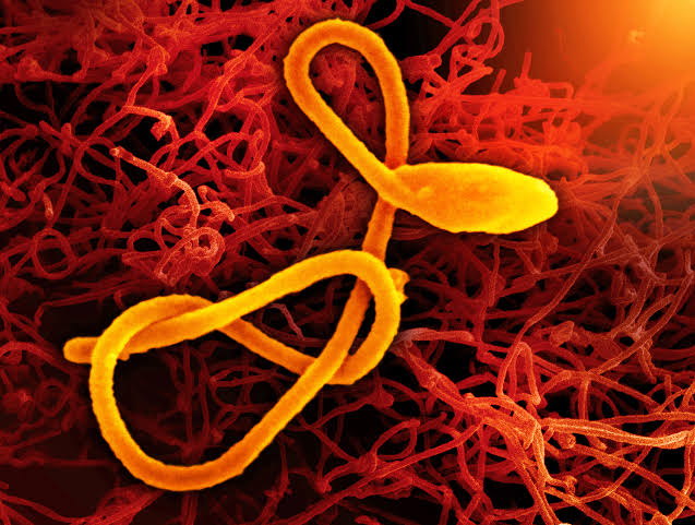WHO drastically downsizes Ebola case count in DR Congo outbreak