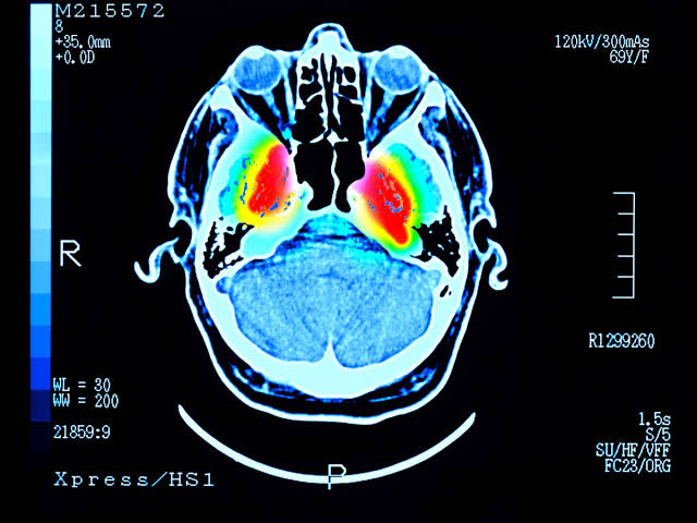 Daily 'fountain of youth' drink could lower dementia and diabetes risk
