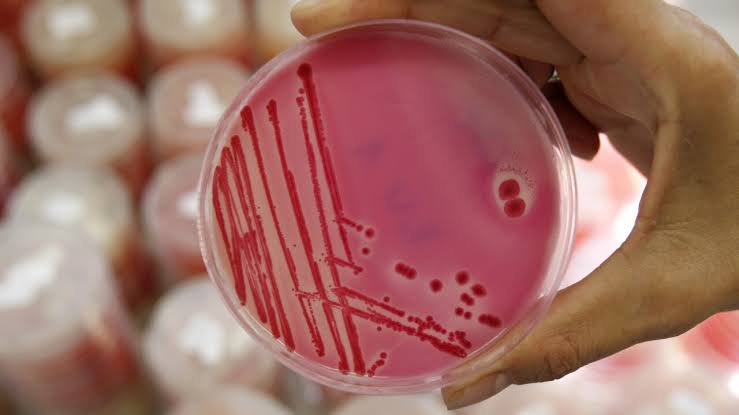 Colorado is seeing a ‘significant increase’ in salmonella cases. Here’s what you should know.