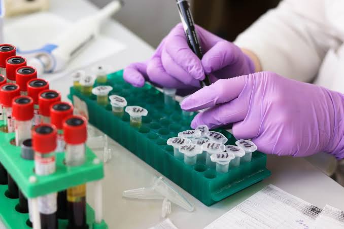 Blood-based test can predict risk of developing symptoms of Alzheimer's up to a decade early